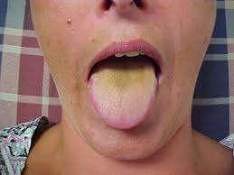 La Lengua